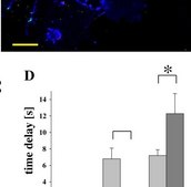 Anti-Actin, α-Smooth Muscle - Cy3™ antibody, Mouse monoclonal clone 1A4, purified from hybridoma cell culture