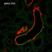 Monoclonal Anti-ENaC alpha antibody produced in mouse clone 2G4