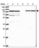 Anti-KLC1 antibody produced in rabbit Prestige Antibodies® Powered by Atlas Antibodies, affinity isolated antibody, buffered aqueous glycerol solution