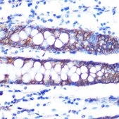 Anti-Occludin antibody produced in rabbit