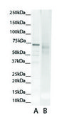 Anti-GCLC antibody produced in rabbit affinity isolated antibody