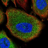 Anti-PYGB antibody produced in rabbit Prestige Antibodies® Powered by Atlas Antibodies, affinity isolated antibody, buffered aqueous glycerol solution