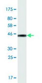 Monoclonal Anti-SOD1 antibody produced in mouse clone 10D5, purified immunoglobulin, buffered aqueous solution