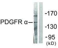 Anti-PDGFR α antibody produced in rabbit affinity isolated antibody