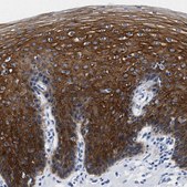 Anti-TRIM29 antibody produced in rabbit Prestige Antibodies® Powered by Atlas Antibodies, affinity isolated antibody, buffered aqueous glycerol solution