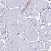 Anti-FTL antibody produced in rabbit Prestige Antibodies® Powered by Atlas Antibodies, affinity isolated antibody, buffered aqueous glycerol solution