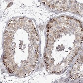 Anti-TUFM antibody produced in rabbit Prestige Antibodies® Powered by Atlas Antibodies, affinity isolated antibody, buffered aqueous glycerol solution