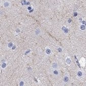 Anti-CACNG3 antibody produced in rabbit Prestige Antibodies® Powered by Atlas Antibodies, affinity isolated antibody, buffered aqueous glycerol solution
