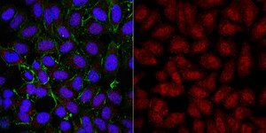 抗-TERT抗体 from rabbit, purified by affinity chromatography