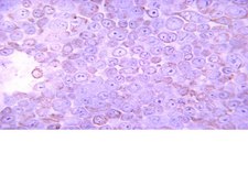 抗酪蛋白激酶2α 抗体，1AD9 clone 1AD9, from mouse