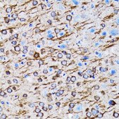 Anti-MAP1LC3A antibody produced in rabbit