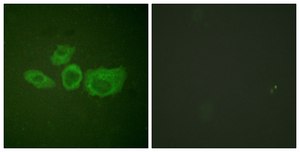 Anti-Tyrosine Hydroxylase, N-Terminal antibody produced in rabbit affinity isolated antibody