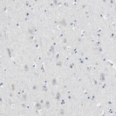 Anti-GZMM antibody produced in rabbit Prestige Antibodies® Powered by Atlas Antibodies, affinity isolated antibody, buffered aqueous glycerol solution