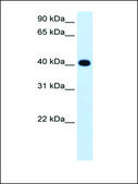 Anti-ADH4 antibody produced in rabbit IgG fraction of antiserum