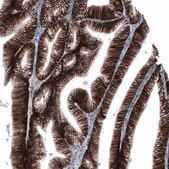 Anti-CD44 antibody produced in mouse Prestige Antibodies® Powered by Atlas Antibodies, clone CL13328, purified by using Protein A, buffered aqueous glycerol solution