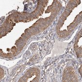Anti-PKM antibody produced in rabbit Prestige Antibodies® Powered by Atlas Antibodies, affinity isolated antibody, buffered aqueous glycerol solution