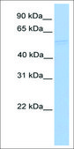 Anti-RUVBL1 antibody produced in rabbit affinity isolated antibody