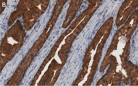 Anti-MIF Antibody, clone 1K16 ZooMAb® Rabbit Monoclonal recombinant, expressed in HEK 293 cells