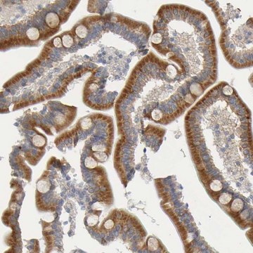 Anti-MOGS antibody produced in rabbit Prestige Antibodies® Powered by Atlas Antibodies, affinity isolated antibody, buffered aqueous glycerol solution