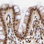 Anti-MED12 antibody produced in rabbit Ab1, Prestige Antibodies® Powered by Atlas Antibodies, affinity isolated antibody, buffered aqueous glycerol solution
