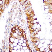 Anti- KEAP1 antibody produced in rabbit