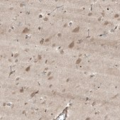 Anti-HMGCR antibody produced in rabbit Prestige Antibodies® Powered by Atlas Antibodies, affinity isolated antibody, buffered aqueous glycerol solution