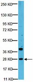Anti-PDGF-BB Antibody from rabbit, purified by affinity chromatography