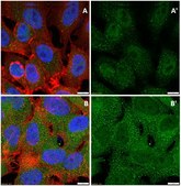 抗胱天蛋白酶3抗体，活性（裂解）形式 Chemicon®, from rabbit