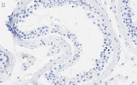 Anti-DAXX Antibody, clone 1L6 ZooMAb® Rabbit Monoclonal recombinant, expressed in HEK 293 cells