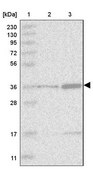 Anti-TRDMT1 antibody produced in rabbit Prestige Antibodies® Powered by Atlas Antibodies, affinity isolated antibody, buffered aqueous glycerol solution