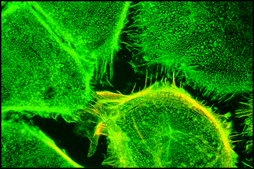 单克隆抗 α-辅肌动蛋白 小鼠抗 clone BM-75.2, ascites fluid