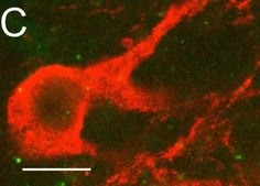 抗-CAR抗体，克隆RmcB clone RmcB, Upstate®, from mouse