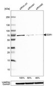 Anti-ESR1 antibody produced in rabbit Prestige Antibodies® Powered by Atlas Antibodies, affinity isolated antibody, buffered aqueous glycerol solution
