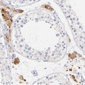 Anti-EBP antibody produced in rabbit Prestige Antibodies® Powered by Atlas Antibodies, affinity isolated antibody, buffered aqueous glycerol solution