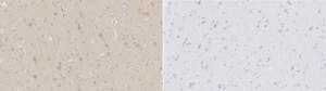 Anti-Choline Transporter Antibody from rabbit, purified by affinity chromatography