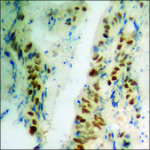 Anti-phospho-p53 (pSer392) antibody produced in rabbit affinity isolated antibody