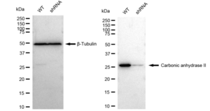 KD-Validated Anti Carbonic anhydrase II Antibody, clone 23GB3300, Rabbit Monoclonal clone 23GB3300, recombinant rabbit monoclonal, expressed in HEK293 cells