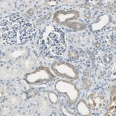 Anti-USP13 antibody produced in rabbit Prestige Antibodies® Powered by Atlas Antibodies, affinity isolated antibody, buffered aqueous glycerol solution