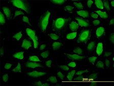 Monoclonal Anti-RRM2 antibody produced in mouse clone 1E1, purified immunoglobulin, buffered aqueous solution