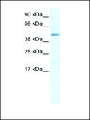 Anti-SMARCB1 antibody produced in rabbit affinity isolated antibody