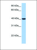 Anti-NR2F2 antibody produced in rabbit affinity isolated antibody