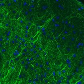 Monoclonal Anti-NEFM antibody produced in mouse Prestige Antibodies® Powered by Atlas Antibodies, clone CL2697, purified immunoglobulin, buffered aqueous glycerol solution
