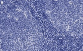 Anti-CD81 Antibody, clone 1C23 ZooMAb® Rabbit Monoclonal recombinant, expressed in HEK 293 cells