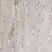 Anti-SYVN1 antibody produced in rabbit Prestige Antibodies® Powered by Atlas Antibodies, affinity isolated antibody, buffered aqueous glycerol solution