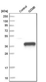 Anti-GZMB antibody produced in rabbit Prestige Antibodies® Powered by Atlas Antibodies, affinity isolated antibody, buffered aqueous glycerol solution