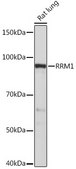Anti-RRM1 Antibody, clone 4P4U1, Rabbit Monoclonal
