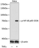 Anti-Phospho-NF-kB p65-S536 antibody produced in rabbit