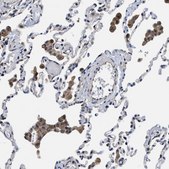 抗-TRAF6 兔抗 Prestige Antibodies® Powered by Atlas Antibodies, affinity isolated antibody, buffered aqueous glycerol solution, Ab1