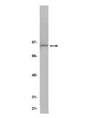 Anti-IKKβ Antibody, clone 10AG2 clone 10AG2, Upstate®, from mouse