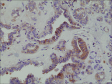 Anti-eIF-2 alpha (Ser51) antibody, Rabbit Monoclonal recombinant, expressed in HEK 293 cells, clone RM298, purified immunoglobulin